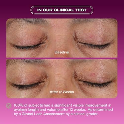 Educated Mess Grow A Pair Lash & Brow Enhancing Serum – Prostaglandin-Free, Non-Irritating Formula (5 ml / 0.17 fl oz) Avelisse