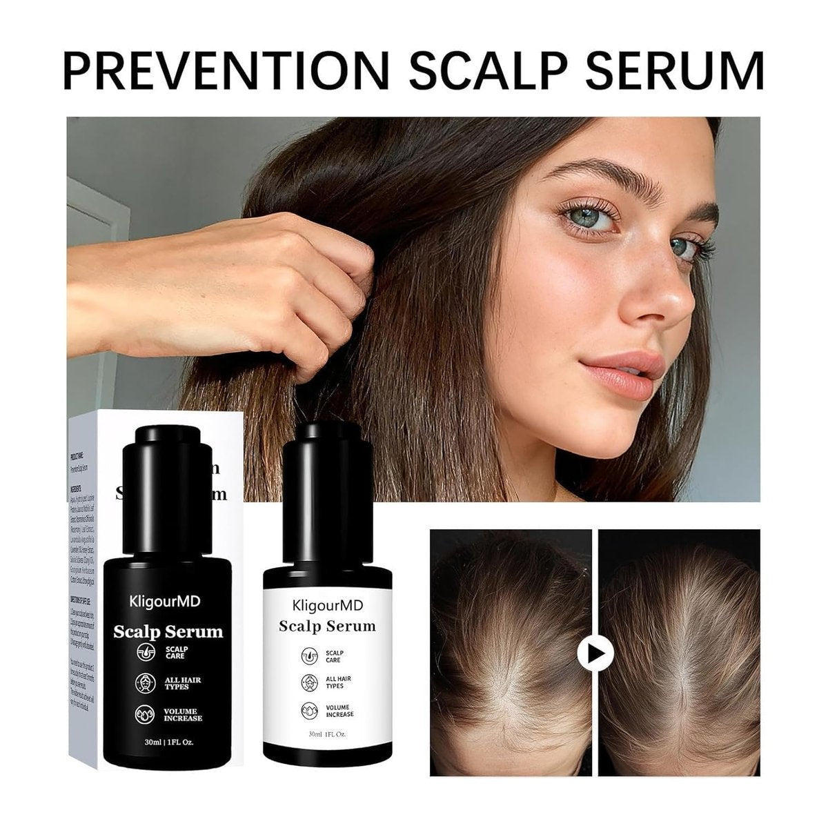 Official Hair Serum Bundle – Thinning Hair Treatment with Plant-Based Actives, Prevention & Treatment Scalp Serum for Men & Women, Reduces Hair Fall (2 x 1 Fl Oz) Avelisse