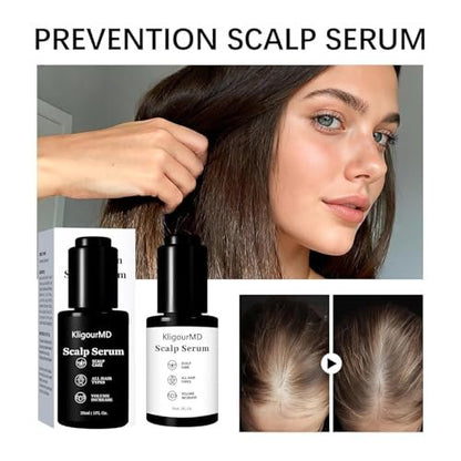 Official Hair Serum Bundle – Thinning Hair Treatment with Plant-Based Actives, Prevention & Treatment Scalp Serum for Men & Women, Reduces Hair Fall (2 x 1 Fl Oz) Avelisse