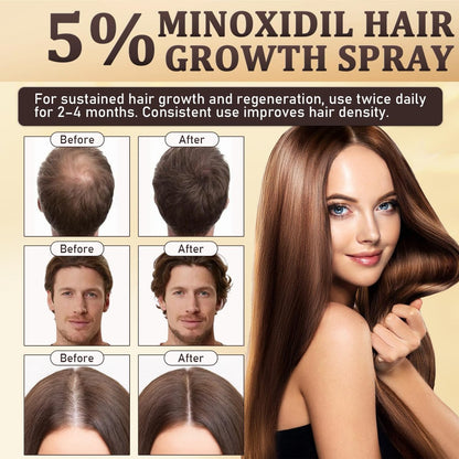 5% Minoxidil for Men & Women - Hair Growth & Beard Regrowth Biotin Serum with Rosemary & Batana Extract, Extra Strength Hair Loss Treatment to Regrow Thicker & Fuller Hair, 3.38 Oz