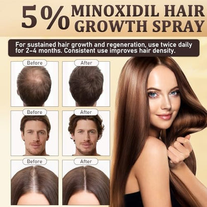 5% Minoxidil for Men & Women - Hair Growth & Beard Regrowth Biotin Serum with Rosemary & Batana Extract, Extra Strength Hair Loss Treatment to Regrow Thicker & Fuller Hair, 3.38 Oz