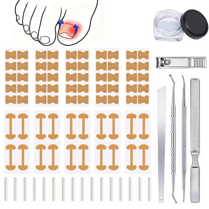 GEMSANVA Ingrown Toenail Corrector Set with Correction Strips – Professional Home Pedicure Care Kit (16 Strips, Beige)