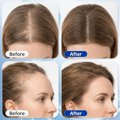 Hair Growth Serum Roll On with 3% Rosemary, 3% Batana Oil, 2% Pea Extract, 2% Ginger Root Oil - Thicker Hair & Stronger Roots (30ml) Avelisse