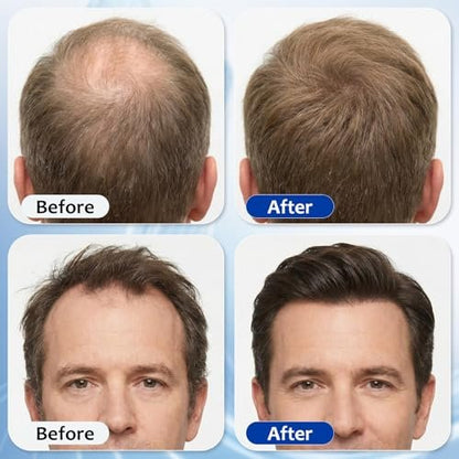 Hair Growth Serum Roll On with 3% Rosemary, 3% Batana Oil, 2% Pea Extract, 2% Ginger Root Oil - Thicker Hair & Stronger Roots (30ml) Avelisse
