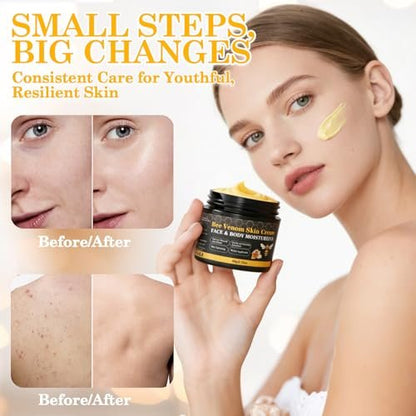 Lustrchron 2-Pack Bee Venom Skin Cream – Natural Anti-Aging Moisturizer for Face & Body, Wrinkle Lift & Firming, Reduces Blemishes (2 x 60g) Avelisse