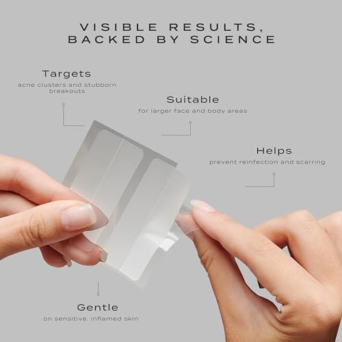 Vue Surface Clearing Patches - Large Pimple Patches for Face & Body, Hydrocolloid Acne Patch for Clusters, Breakouts and Oil Control, Gentle for Sensitive Skin (10-Count) Avelisse