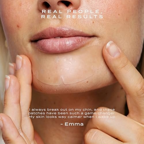 Vue Chin Patches – Hydrocolloid Pore Patches for Chin and Jawline Breakouts, Pimples, Oil Control and Texture Smoothing, Gentle for All Skin Types (8 Count) Avelisse