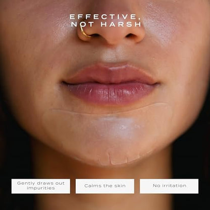 Vue Chin Patches – Hydrocolloid Pore Patches for Chin and Jawline Breakouts, Pimples, Oil Control and Texture Smoothing, Gentle for All Skin Types (8 Count) Avelisse