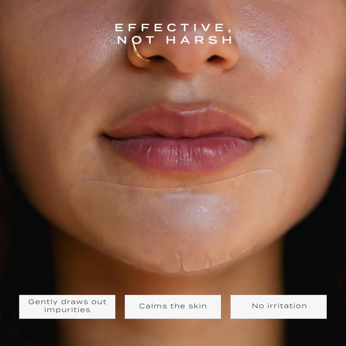 Vue Chin Patches – Hydrocolloid Pore Patches for Chin and Jawline Breakouts, Pimples, Oil Control and Texture Smoothing, Gentle for All Skin Types (8 Count) Avelisse