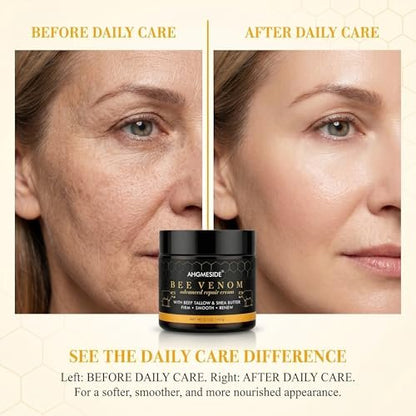 Bee Venom Cream – Natural Anti-Aging & Firming Moisturizer for Dry, Mature & Stressed Skin, 2.1 oz Avelisse
