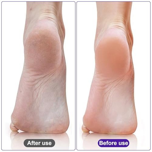 Uncle Yang Pumice Stone for Feet 4 Pack - Double Sided Pedicure Tools for Callus Removal and Dead Skin - görsel 9