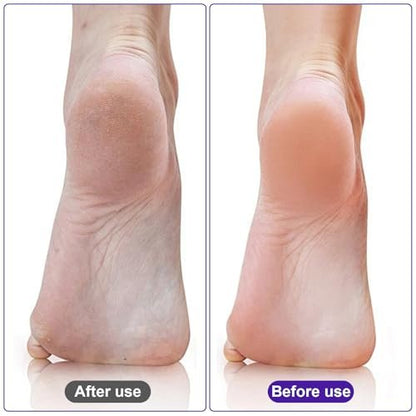 Uncle Yang Pumice Stone for Feet 4 Pack - Double Sided Pedicure Tools for Callus Removal and Dead Skin