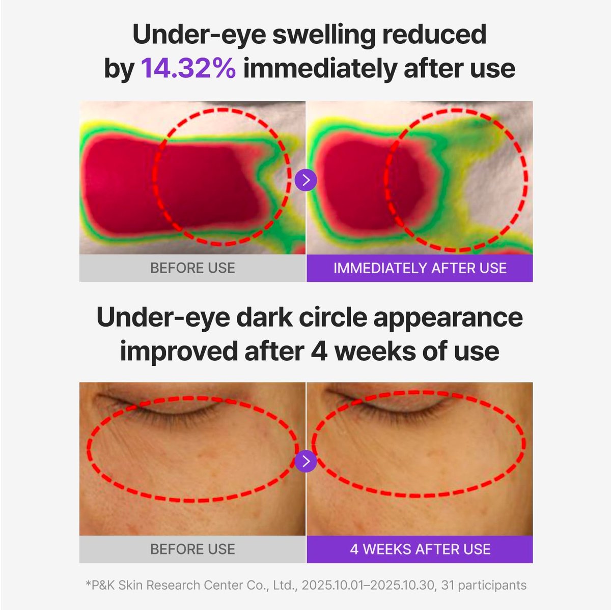 CENTELLIAN 24 360 Shot PDRN Glowing Eye Patch (6 Sets, 12ea) – Instant Depuffing & Dark Circle Revitalizing Hydrogel Under Eye Patches with PDRN, Retinol & Glutathione Avelisse