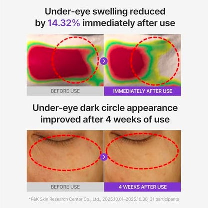 CENTELLIAN 24 360 Shot PDRN Glowing Eye Patch (6 Sets, 12ea) – Instant Depuffing & Dark Circle Revitalizing Hydrogel Under Eye Patches with PDRN, Retinol & Glutathione Avelisse
