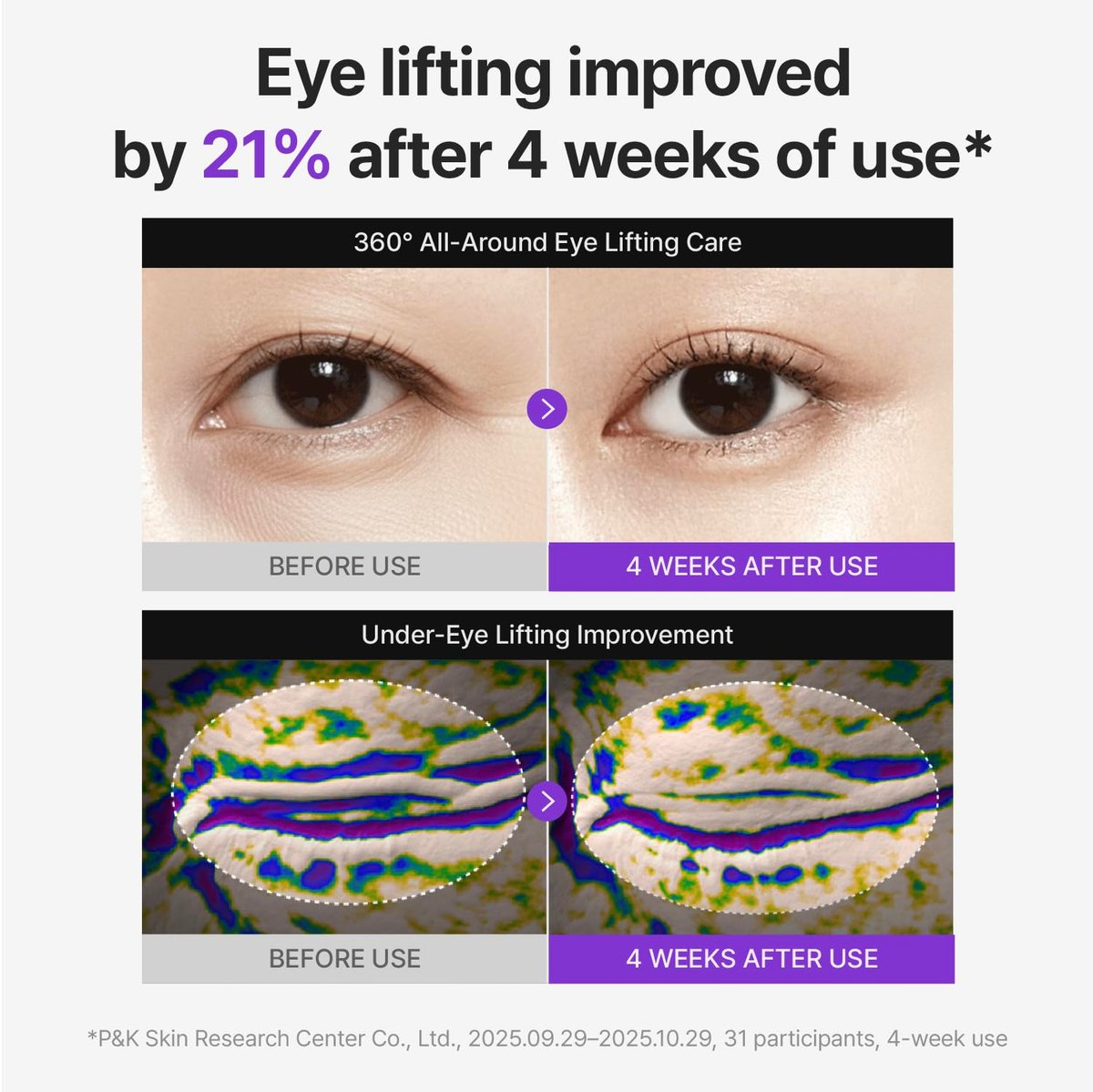 Centellian24 360 Shot PDRN Firming Eye Cream 30ml – Anti-Aging Retinol Eye Cream for Hooded Eyes, Wrinkle Smoothing, Firming Hydrating Care for Under-Eye Bags, Crow’s Feet & Dark Circles Avelisse
