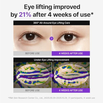 Centellian24 360 Shot PDRN Firming Eye Cream 30ml – Anti-Aging Retinol Eye Cream for Hooded Eyes, Wrinkle Smoothing, Firming Hydrating Care for Under-Eye Bags, Crow’s Feet & Dark Circles Avelisse