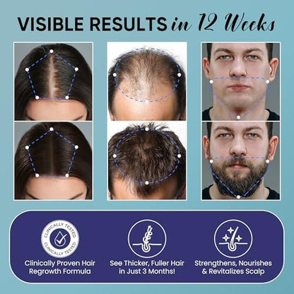 5% Minoxidil Hair Growth Kit for Men and Women - Spray Treatment with Biotin & Rosemary, Stop Hair Loss, Stronger Thicker Hair, 2 Pack Avelisse