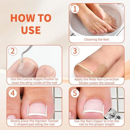 Ingrown Toenail Removal Kit - Complete Corrector Tool with Correction Strips, Toe Separators, Painless File and Lifter for Home Pedicure Care