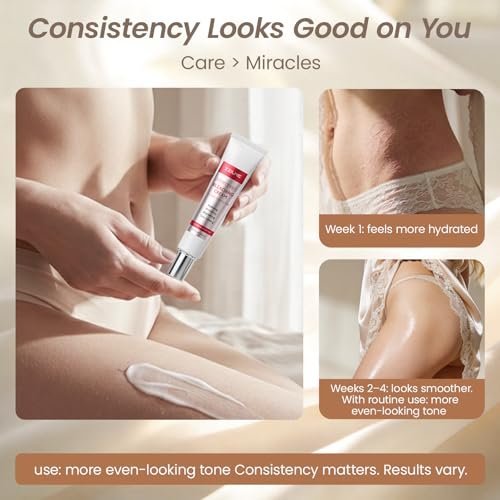 ZZILME Intimate Brightening Body Cream for Women – Niacinamide, Vitamin C & Aloe Moisturizer for Underarms, Bikini Line, Knees & Inner Thighs – 1.7 fl oz Avelisse