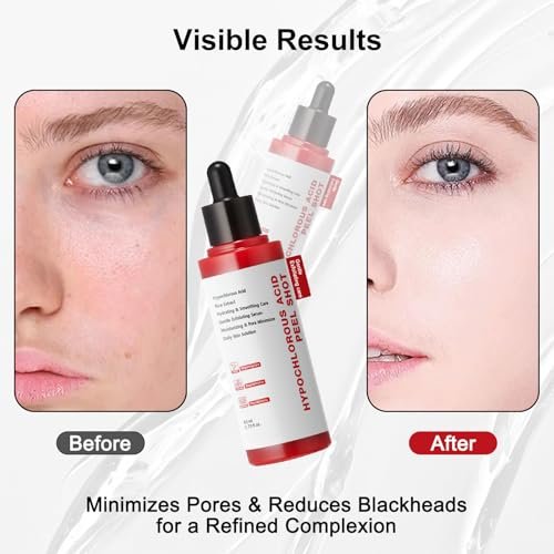 Gentle Exfoliating Serum with Hypochlorous Acid & Rice Extract - Daily Peel Solution for Smooth & Radiant Skin - 80ml Avelisse