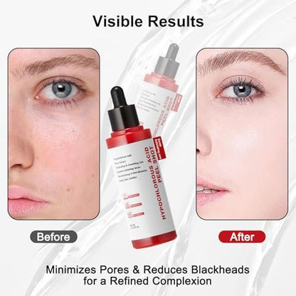 Gentle Exfoliating Serum with Hypochlorous Acid & Rice Extract - Daily Peel Solution for Smooth & Radiant Skin - 80ml Avelisse