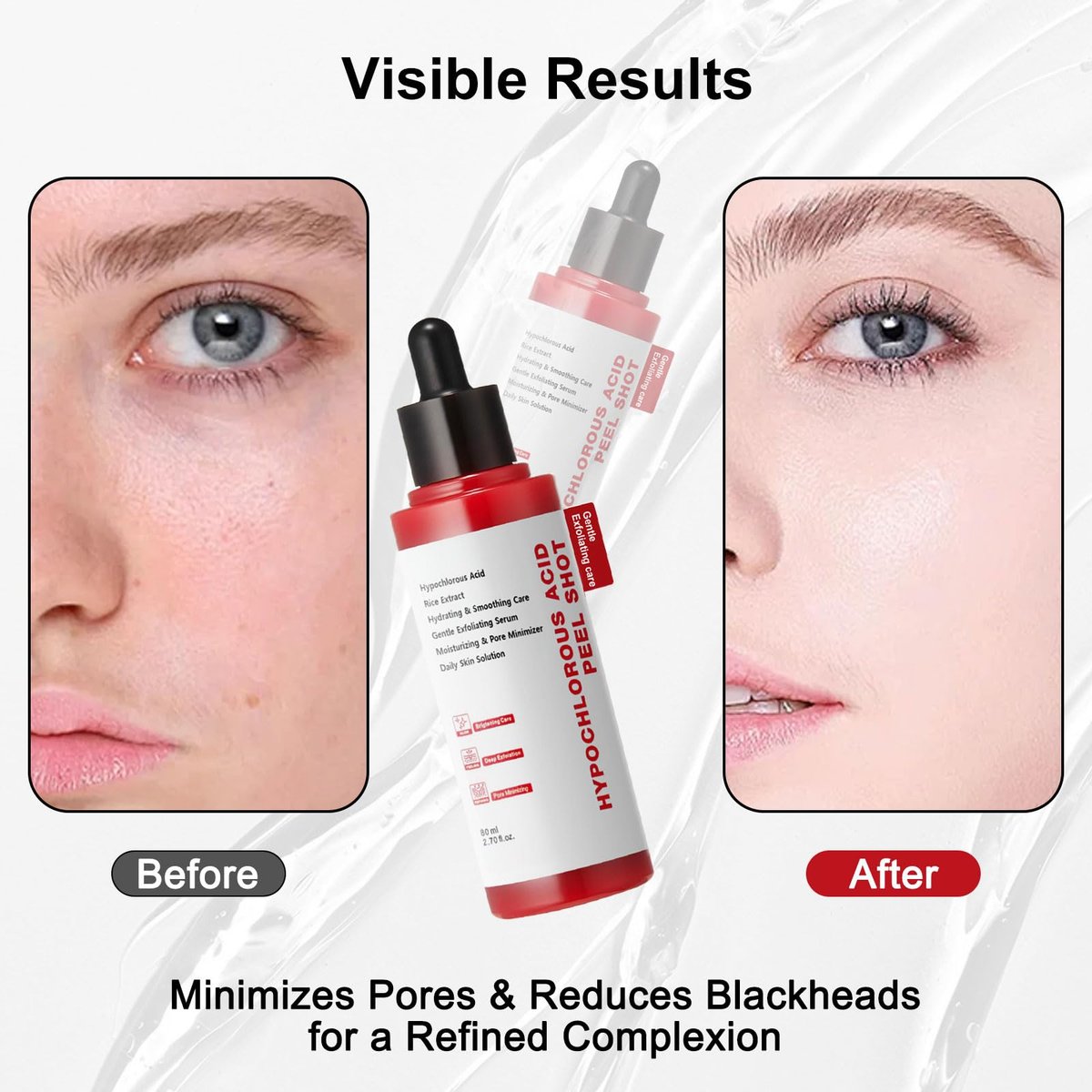 Gentle Exfoliating Serum with Hypochlorous Acid & Rice Extract - Daily Peel Solution for Smooth & Radiant Skin - 80ml Avelisse