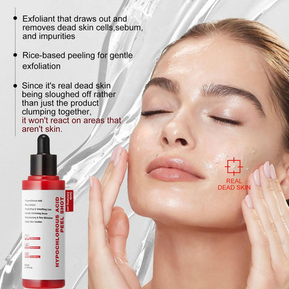 Gentle Exfoliating Serum with Hypochlorous Acid & Rice Extract - Daily Peel Solution for Smooth & Radiant Skin - 80ml Avelisse