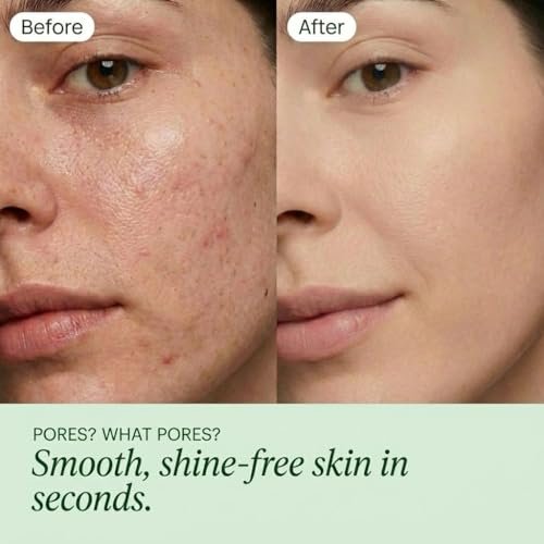 QUIA Toner Pads – AHA/BHA Dual-Action Exfoliate and Hydrate All in One – Soothing Formula for Sensitive Skin – Reduces Blackheads and Blemishes – 70 Gentle Textured Pads – Korean Skincare Avelisse