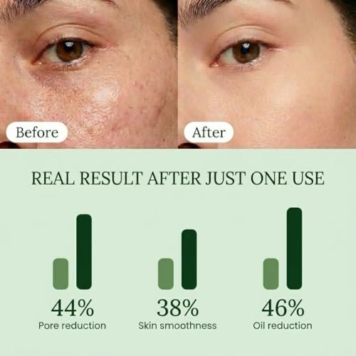QUIA Toner Pads – AHA/BHA Dual-Action Exfoliate and Hydrate All in One – Soothing Formula for Sensitive Skin – Reduces Blackheads and Blemishes – 70 Gentle Textured Pads – Korean Skincare Avelisse