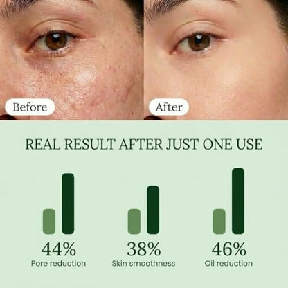 QUIA Toner Pads – AHA/BHA Dual-Action Exfoliate and Hydrate All in One – Soothing Formula for Sensitive Skin – Reduces Blackheads and Blemishes – 70 Gentle Textured Pads – Korean Skincare Avelisse
