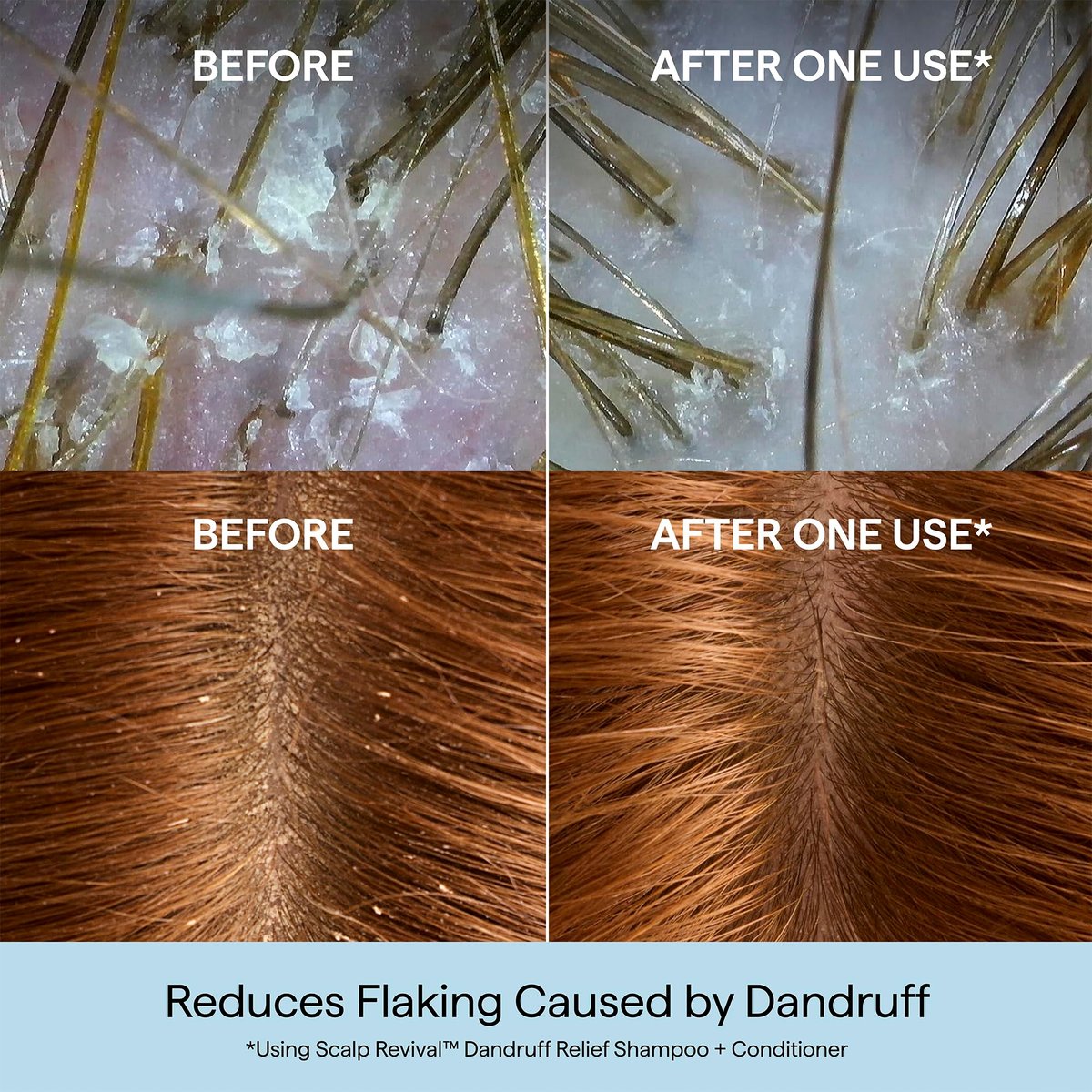 Briogeo Scalp Revival Dandruff Relief Shampoo with Charcoal + 3% Salicylic Acid - Daily Anti-Dandruff Shampoo for Flakes, Itch & Irritation - Color-Safe - Vegan & Cruelty-Free - 8.4 fl oz Avelisse