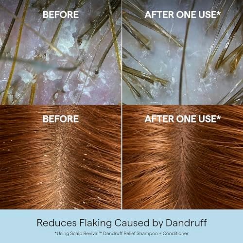 Briogeo Scalp Revival Dandruff Relief Shampoo with Charcoal + 3% Salicylic Acid - Daily Anti-Dandruff Shampoo for Flakes, Itch & Irritation - Color-Safe - Vegan & Cruelty-Free - 8.4 fl oz Avelisse
