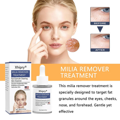 Milia Remover for Face - Milia Bump Remover Under Eye, Spot Treatment Serum with Salicylic Acid, Milia Acne Cream 30ml Avelisse