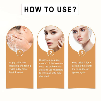 Milia Remover for Face - Milia Bump Remover Under Eye, Spot Treatment Serum with Salicylic Acid, Milia Acne Cream 30ml Avelisse