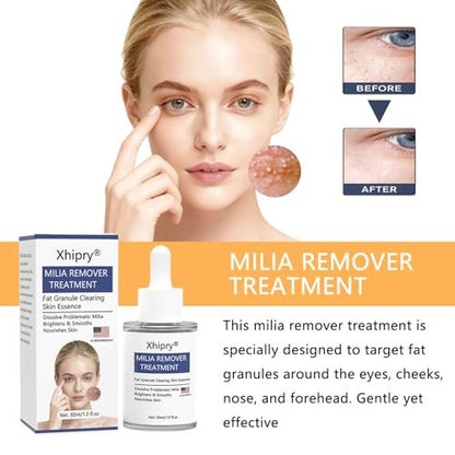 Milia Remover for Face - Milia Bump Remover Under Eye, Spot Treatment Serum with Salicylic Acid, Milia Acne Cream 30ml Avelisse