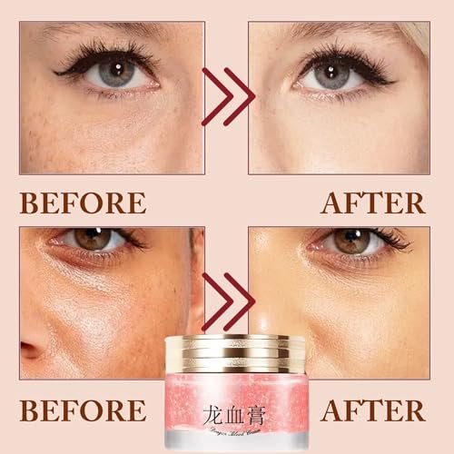 Dragons Blood Cream with Retinol - Nourishing & Firming Face Moisturizer for All Skin Types Avelisse