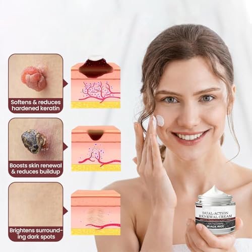 KeraErase Dual-Action Renewal Cream – Black & White Rice Soothing Repair Cream for Smooth, Refined Skin (2-Pack) Avelisse