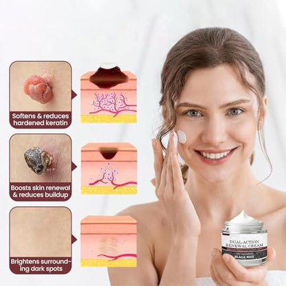 KeraErase Dual-Action Renewal Cream – Black & White Rice Soothing Repair Cream for Smooth, Refined Skin (2-Pack) Avelisse