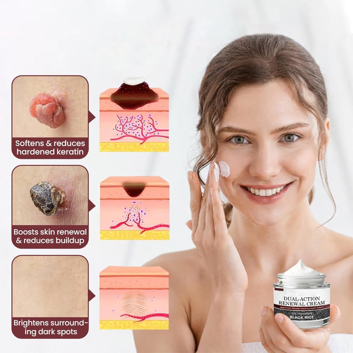 KeraErase Dual-Action Renewal Cream – Black & White Rice Soothing Repair Cream for Smooth, Refined Skin (2-Pack) Avelisse