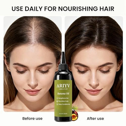 Ariyv Batana Oil for Hair Growth – Natural Batana Oil Prevents Hair Loss, Reduces Breakage, Strengthens Hair, Enhances Thickness for Men & Women (4 Fl Oz) Avelisse