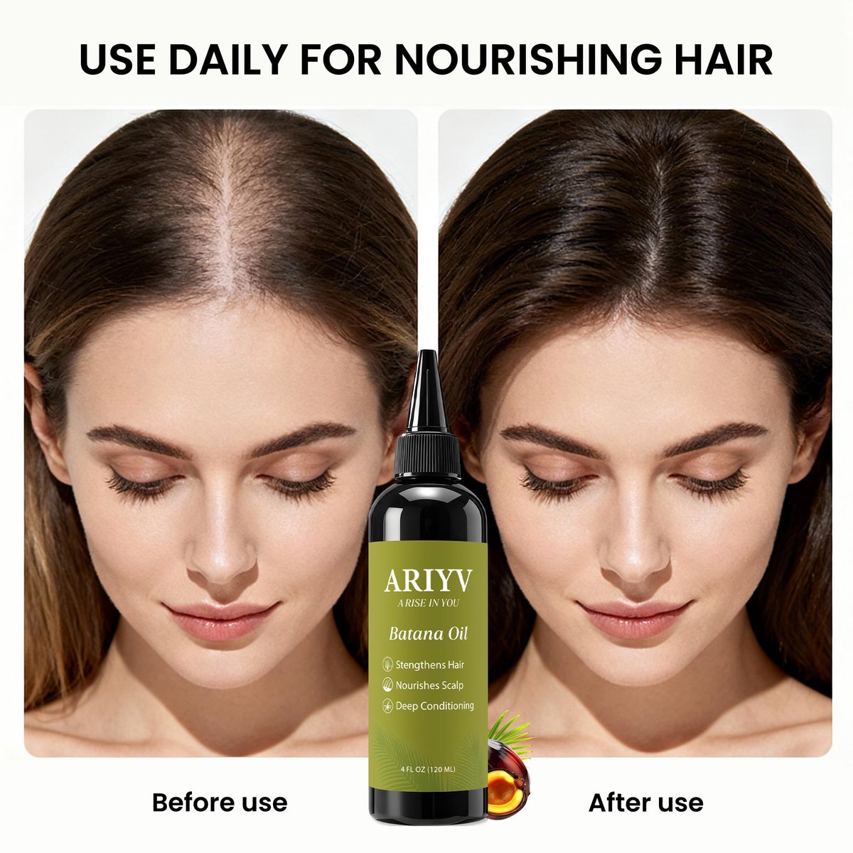 Ariyv Batana Oil for Hair Growth – Natural Batana Oil Prevents Hair Loss, Reduces Breakage, Strengthens Hair, Enhances Thickness for Men & Women (4 Fl Oz) Avelisse