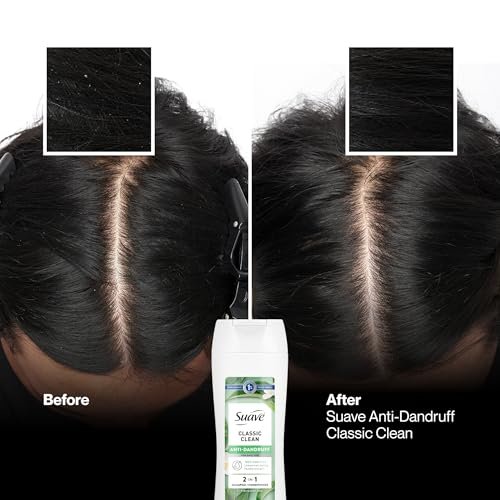 Suave Anti Dandruff 2-in-1 Shampoo & Conditioner for Women, Classic Clean, 1% Pyrithione Zinc Dandruff Treatment, Controls Flakes, Itch & Dry Scalp, 6 Count, 12.6 FL OZ Each Avelisse