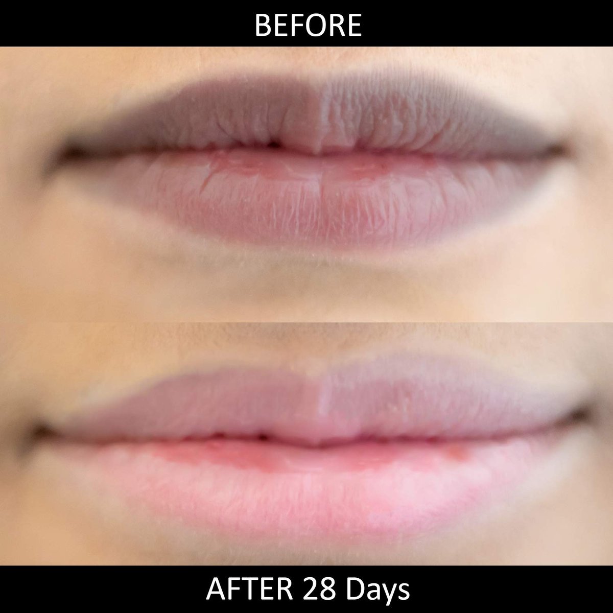 Omorfee Lip Lightening Salve - Natural Lip Balm for Dark Lips with SPF Protection, Cocoa Butter, Carrot Seed Oil & Pineapple Extract (0.35 oz) Avelisse