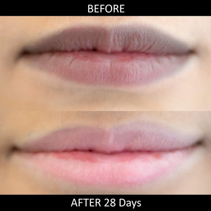 Omorfee Lip Lightening Salve - Natural Lip Balm for Dark Lips with SPF Protection, Cocoa Butter, Carrot Seed Oil & Pineapple Extract (0.35 oz) Avelisse