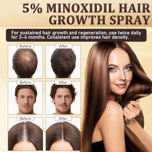 5% Minoxidil Hair Growth Spray for Men & Women with Biotin, Rosemary & Batana Extracts - Extra Strength Treatment for Hair Loss, Thinning & Beard Regrowth, 3.38 Fl Oz - görsel 10