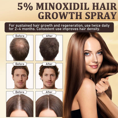 5% Minoxidil Hair Growth Spray for Men & Women with Biotin, Rosemary & Batana Extracts - Extra Strength Treatment for Hair Loss, Thinning & Beard Regrowth, 3.38 Fl Oz