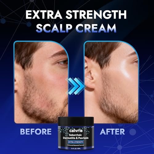 Calvris Extra Strength Scalp Cream – Flake & Itch Relief for Dandruff and Dry Scalp, Enhanced Botanical Formula, 3.4 fl oz Avelisse