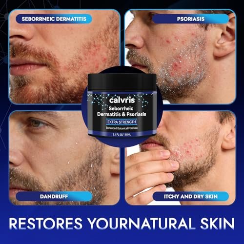Calvris Extra Strength Scalp Cream – Flake & Itch Relief for Dandruff and Dry Scalp, Enhanced Botanical Formula, 3.4 fl oz Avelisse