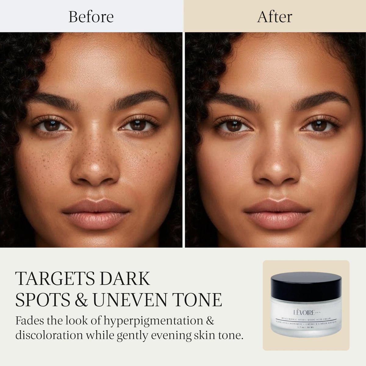 LEVOIRE SKIN Kojic Acid and Hyaluronic Acid Face Cream - Hydrating Brightening Moisturizer & Dark Spot Remover for Glowing Skin - with Aloe, Shea Butter & Licorice Root, Vegan, 2 oz - görsel 5
