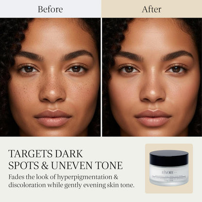 LEVOIRE SKIN Kojic Acid and Hyaluronic Acid Face Cream - Hydrating Brightening Moisturizer & Dark Spot Remover for Glowing Skin - with Aloe, Shea Butter & Licorice Root, Vegan, 2 oz